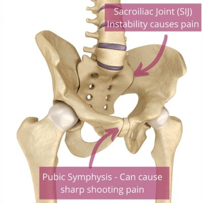 pelvic-girdle-pain